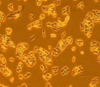Potential new breakthroughs in liver cancer research