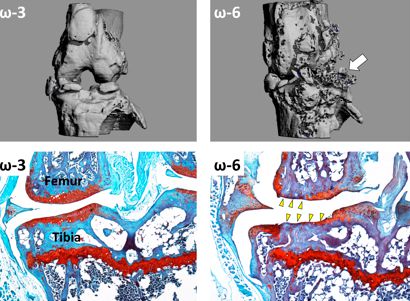 Omega 3 fatty acids reduce the severity of osteoarthritis in mice