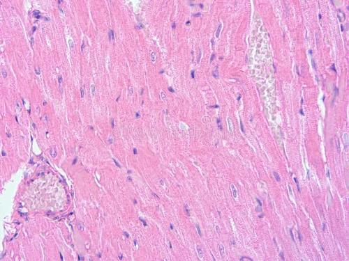 A small fish provides clues to reconstruct damaged heart tissue